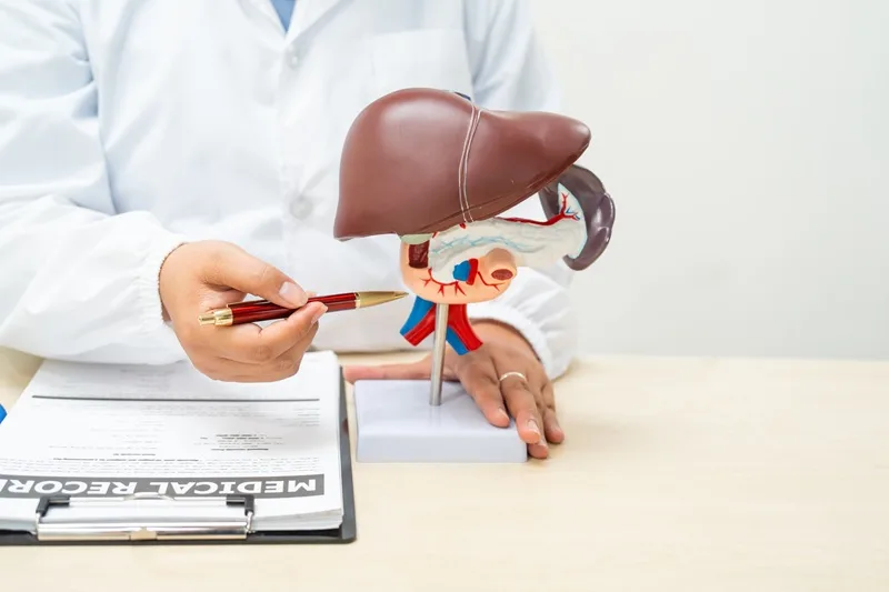 Cáncer de páncreas