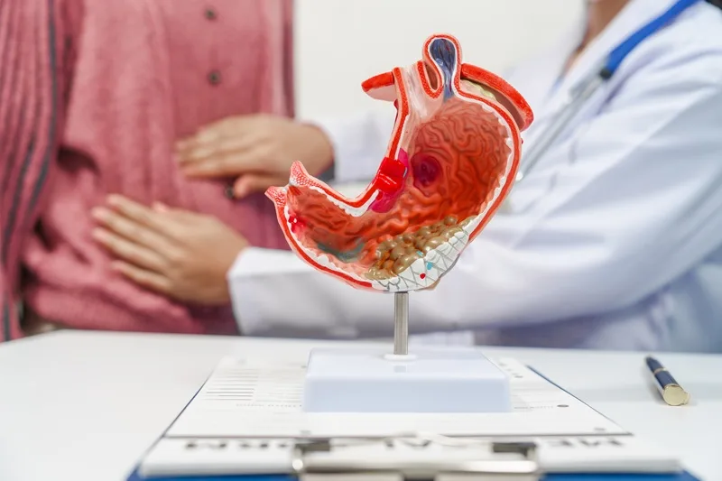 Cáncer gástrico