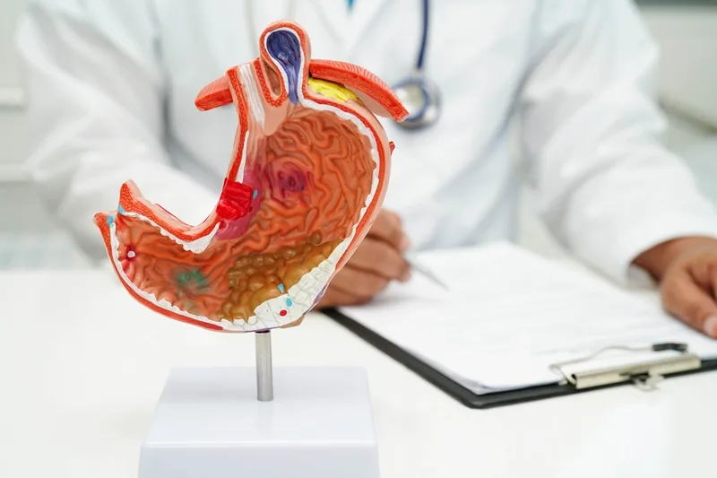 Cáncer gástrico